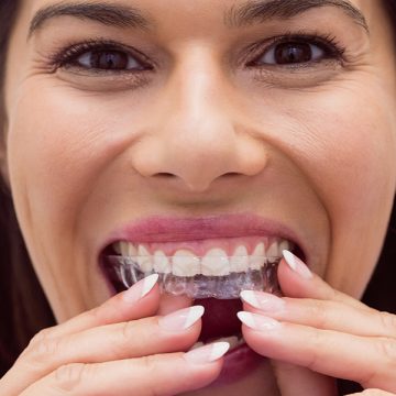 Why do you need a Dental night guard