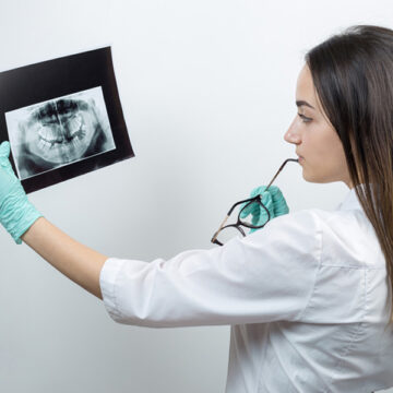 Herbal Teas and Their Benefits in Bone Graft Recovery