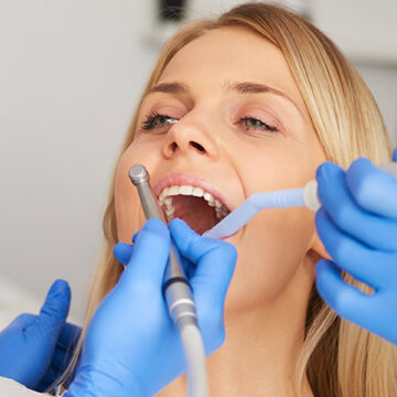 Scaling & Root Planing: Deep Cleaning for Healthier Gums