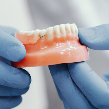 The Impact of Missing Teeth on Teenagers and How Dental Bridges Can Help