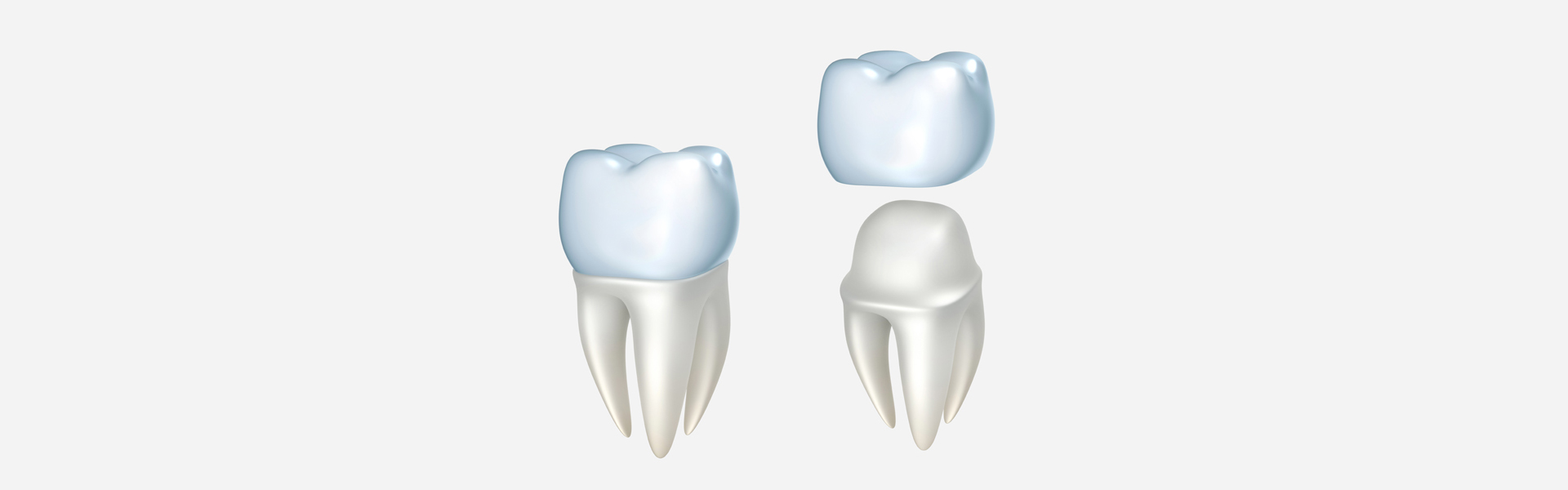 Same-Day Crowns at KK Dental