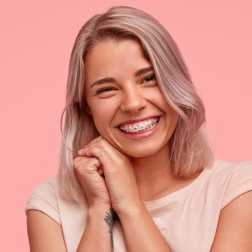 What Are the Benefits of Having Braces?