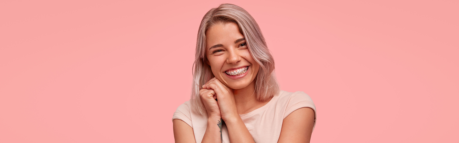 What Are the Benefits of Having Braces?
