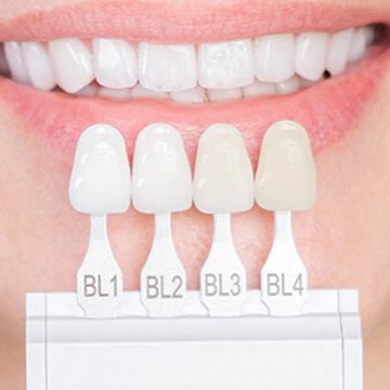 The Benefits of Choosing Same-Day Dental Crowns Over Traditional Crowns