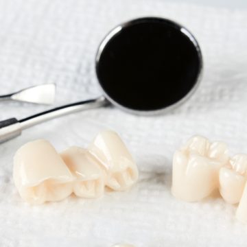 What is the Same-Day Dental Crown Procedure Like? A Step-by-Step Guide
