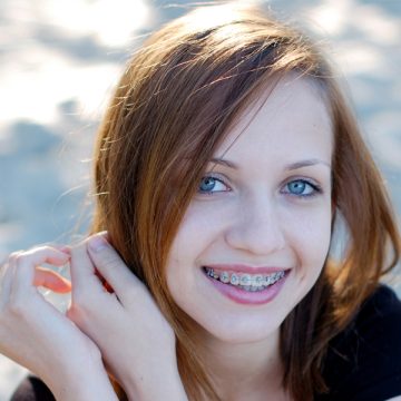 Dental Braces Tightening/Appointments in North Brunswick: What Happens Each Visit?