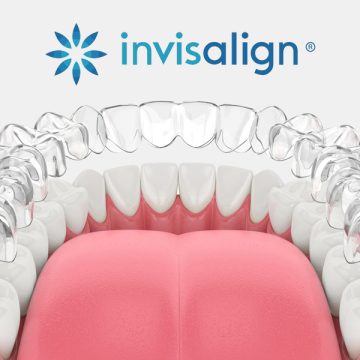 Is Invisalign or Clear Aligner Treatment Covered Under PPO Insurance?