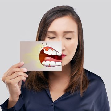 How Modern Gum Treatments in Somerset Are Changing Smiles?