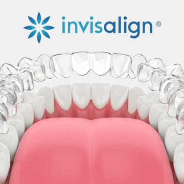 Braces or Invisalign? Compare Your Options with an $85 Orthodontic Consultation